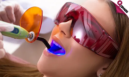 Tooth Filling, X-ray + Consultation!